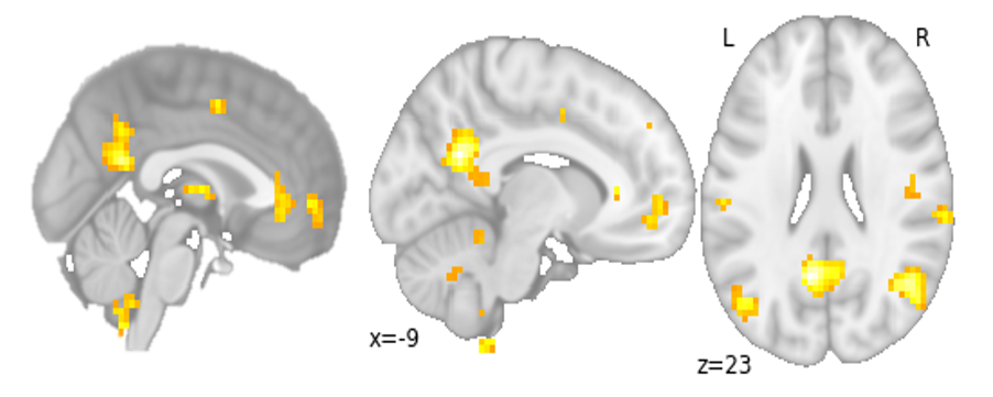 Brain decoding